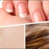 Skin, Hair & Nail